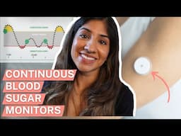 Continuous blood glucose monitors - do we need them?