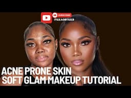 Soft Glam Makeup Tutorial Acne