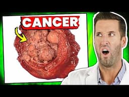 Is There a Cure for Cancer? | Reacting to Your Medical Questions