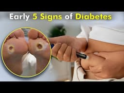 Know your early 5 symptoms of Diabetes