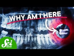 Why Do We (Still) Have Wisdom Teeth?