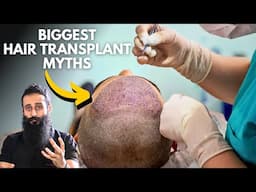 Biggest Hair Transplants Myths | Bearded Chokra