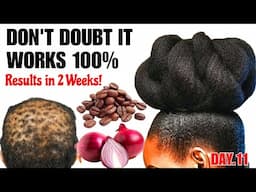 DAY 11: MIX ONION & COFFEE FOR EXTREME X10 FASTER HAIR GROWTH! Try it