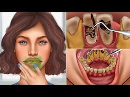 ASMR Remove giant tartar stuck between teeth | Dental care animation