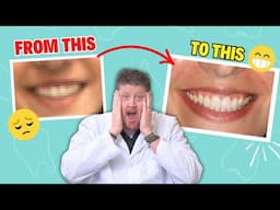 Smile Makeover with Veneers | Dr. Brett Langston