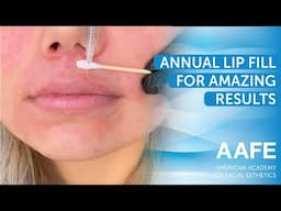 Annual Lip Fill for Amazing Results