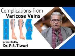 Complications from Varicose Veins -- Dr P S Tiwari #homeopathy