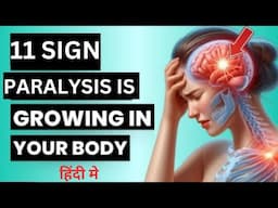 paralysis symptoms||paralyasis kya hota hai||paralysis kaise hota hai||lakawa kya hai||paralyasis