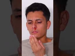 Stop a Nosebleed Fast with This Simple Hack!