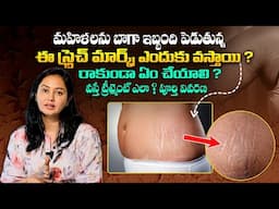 స్ట్రెచ్ మార్క్స్ పోవాలంటే ఎలా ? Causes Of Stretch Marks and Removal || Dr Deepthi Devarakonda | THF