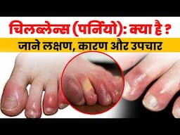 Chilblains Causes,Prevention,and Treatment | चिलब्लेन्स (पर्नियो) क्या है ? जाने लक्षण,कारण और उपचार