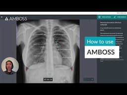 How to use AMBOSS for MD Students: Unlocking Success in In-House Exams and Step 1