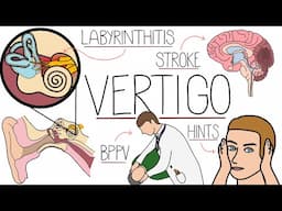 Vertigo Made Easy - Causes, Symptoms and Treatment