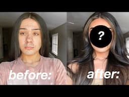 I GOT PLASTIC SURGERY *not clickbait*