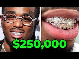 The four Most Expensive Grillz Money Can Buy...You Won't Believe #1!