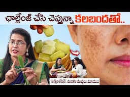 కలబందతో ఇలాచేస్తే పిగ్మెంటేషన్, మంగు మచ్చలు మాయం | Get Rid Of Pigmentation | Aloe Vera | Shobha Rani