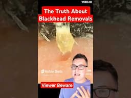 Ultimate BLACKHEAD REMOVAL Closeup #shorts