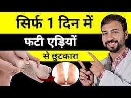 सिर्फ 1 दिन में फटी एड़ियों (Cracked Heels) से पाए छुटकारा | Cracked Heels Home remedy