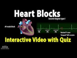 Heart (AV) Blocks - INTERACTIVE Animation with Quiz.