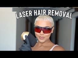 Get in shug, We're getting Laser Hair Removal! + How to Prep for your 1st Laser Treatment