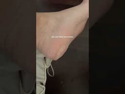 pov: your heels have corners  #pedicure #callusremoval