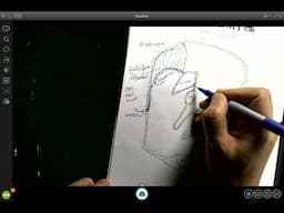 Introduction to Peritoneum