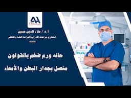 حاله ورم ضخم بالقولون متصل بجدار البطن والأمعاء