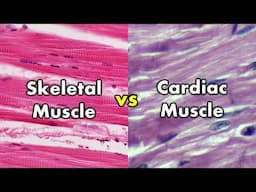 Differentiating Skeletal Muscle and Cardiac Muscle | Striations vs Intercalated Discs