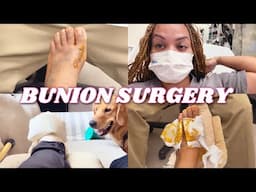 BUNION SURGERY 🥺 | Healing process, Pain, Sutures Removal, Recovery 💕