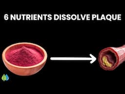 6 Natural Nutrients That Dissolve Arterial Plaque