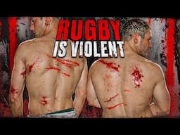 You Shouldn't Watch This Brutal Rugby Video!