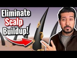 How to Eliminate Scalp Buildup in 5 Easy Steps