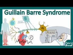 Guillain-Barré Syndrome (GBS) | Guillain-Barré Syndrome Explained: Causes, Symptoms & Treatment