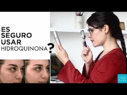 Blanquear la piel con HIDROQUINONA: es seguro? / Quitar manchas rápidamente con hidroquinona