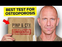 Why Your Doctor May Not Order These Critical Bone Tests… [P1NP & CTX Explained]