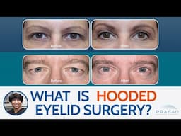 What is Surgery for Hooded Eyelids?