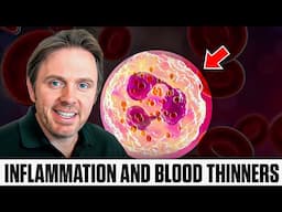 How to Reduce Inflammation Fast - The TRUTH About Blood Thinners