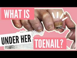 Pedicure Tutorial: How to Tell Nail Damage or Nail Fungus