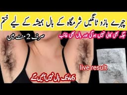 stop Shaving 👉This simple thing cleaned beard and mustache surprised 😱|| facial hair removal at home