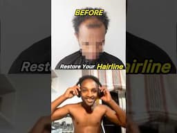 Dating Advice for receding hairlines 🇨🇦 #hairunit #mensfashion #hairsystem  #datingadvice