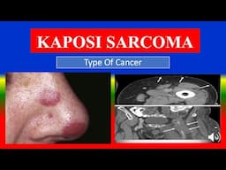 KAPOSI SARCOMA - Definition, types, causes, pathophysiology, symptoms , diagnoses , medicine