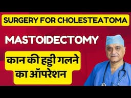 Mastoidectomy । kan ki gali hui haddi ka operation ।Cholesteatoma surgery। Hindi