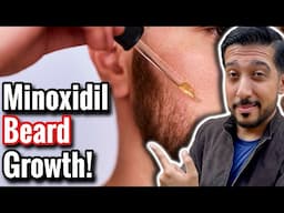 Minoxidil for Beard Growth | Does Minoxidil REALLY Help Beard Growth?