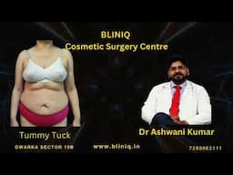 Tummy Tuck Transformation!! Watch Live