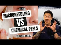 Microneedling vs Chemical Peels - Which is Better? | Dr Davin LIm