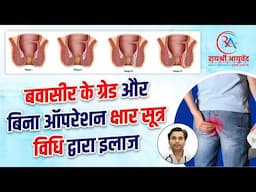 Different Grade of Piles & Effective Treatment | बवासीर के ग्रैड एवं इलाज | Dr. Manish yadav, Kanpur