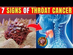 7 Signs and Symptoms of Throat Cancer| Healthy Care