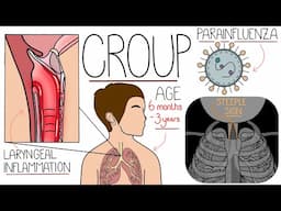 Croup Explained Clearly in 3 Minutes (With Barking Cough Sound)