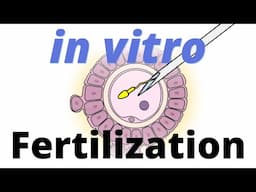 In Vitro Fertilization (IVF) explained