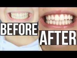 HOW TO GET SUPER WHITE TEETH! + SmileBrilliant GIVEAWAY